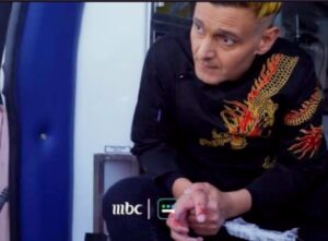 صورة لرامز جلال بعد إصابته بلدغة ثعبان